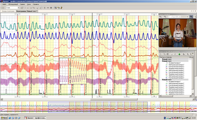 a polygram from russian computerized polygraph PIK-02